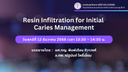 12011 Resin Infiltration for Initial Caries Management